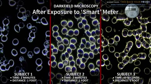 Smart Meters and negative effect on human body