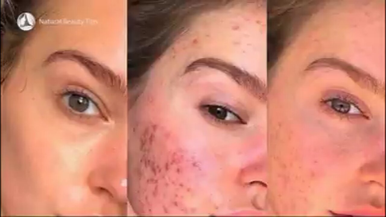 Beauty Secret