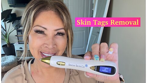 SKIN TAGS REMOVAL ON MY NECK WITH SNOWSKIN DEVICE