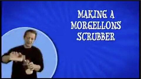 Morgellons detox lotion by Tony February 2019