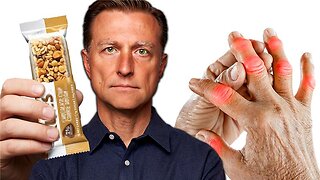 NEVER Eat These 7 Foods If You Have Arthritis