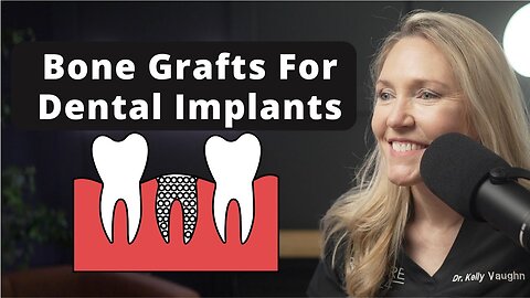 Dental Implants: Why Bone Grafts Are Essential!