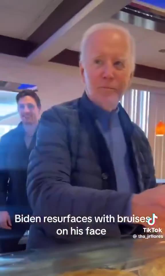 What do you think happened? Joe Biden was seen with bruises on his face and around left eye
