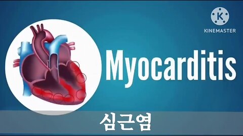 #심근염자가치료#Myocarditis#DrEricBerg -