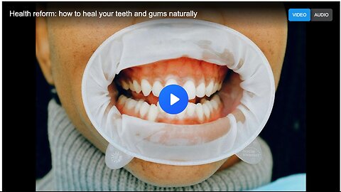 Health reform: how to heal your teeth and gums naturally