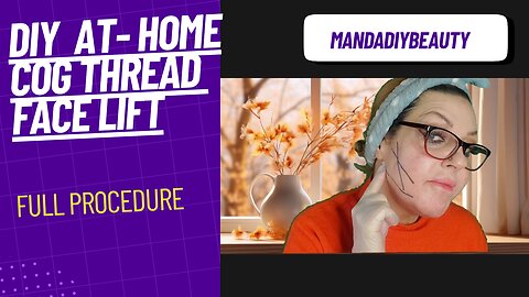 DIY at- Home Cog Thread Face Lift- full Procedure