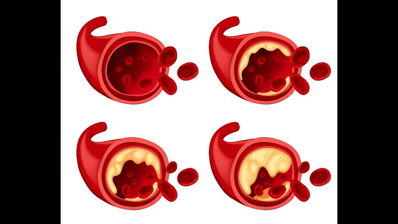 The “cell clog” that traps your sugar inside you