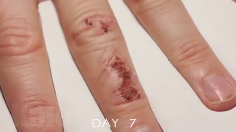 🤯💫 Watch This Wound Heal Itself in a Breathtaking Timelapse! | FeedMyCuriosity