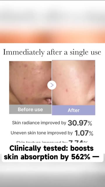 medicube Mini Booster Pro White | Affordable at-Home Facial Device for