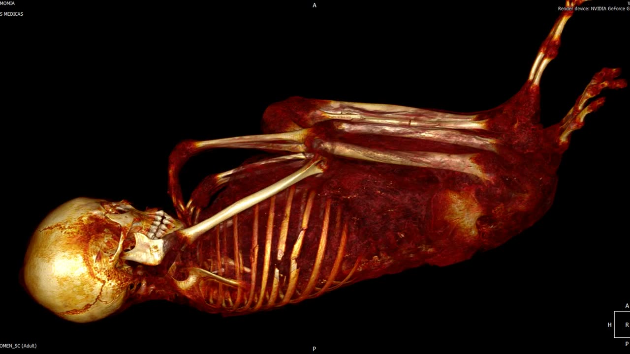 📰👽 Antonio's Medical Scan Released by Daily Mail: What Does It Show? | TheTruthAbove