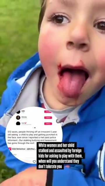 Little boy punched in the face by migrant kids