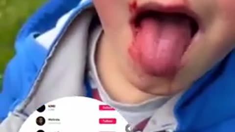 Little boy punched in the face by migrant kids