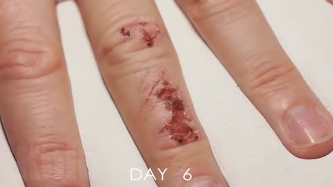 😮✨ Watch A Wound Heal in Stunning Timelapse! | FeedMyCuriosity