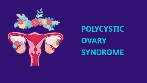 Understanding PCOS :Symptoms, Causes and Treatment