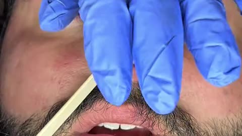 Nose Waxing with Sexy Smooth Sexy Sapphire Hard Wax | @debbietheesthie | Gentle & Quick Results