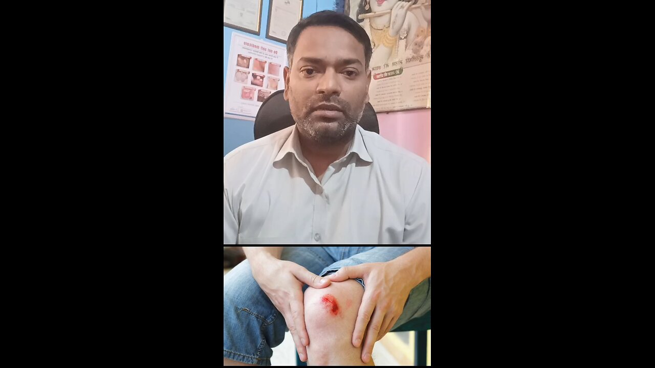 घाव को ठीक करने का इलाज ।