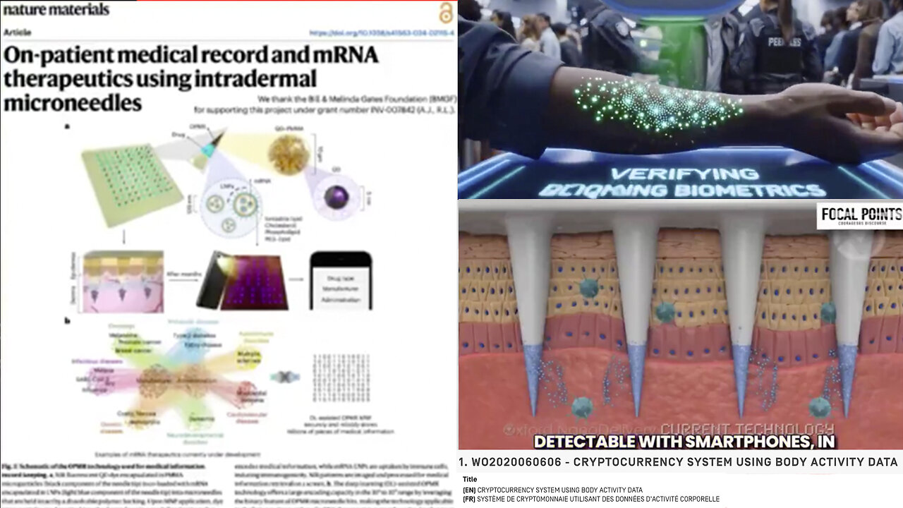 6G | Is 6G Technology Needed to Implement the Bill Gates’ New Micro-Needle Patch implant (Mark) That installs Modified mRNA & Permanent Quantum-dot “QR Codes” Into Your Body? What Is Internet of Bodies Technology?