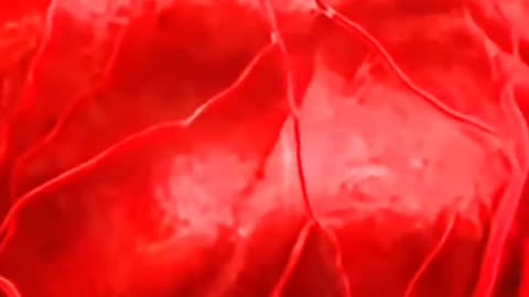 Chemotherapy Procedure — How Cancer-Fighting Drugs Work Inside the Body