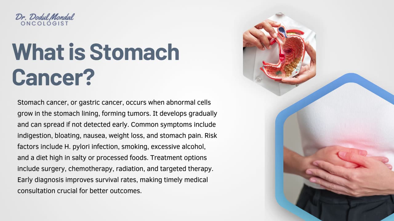 Everything You Need to Know About Stomach Cancer: Symptoms, Causes, and Treatments