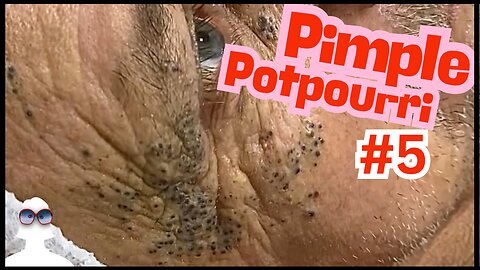 PIMPLE Potpourri #5