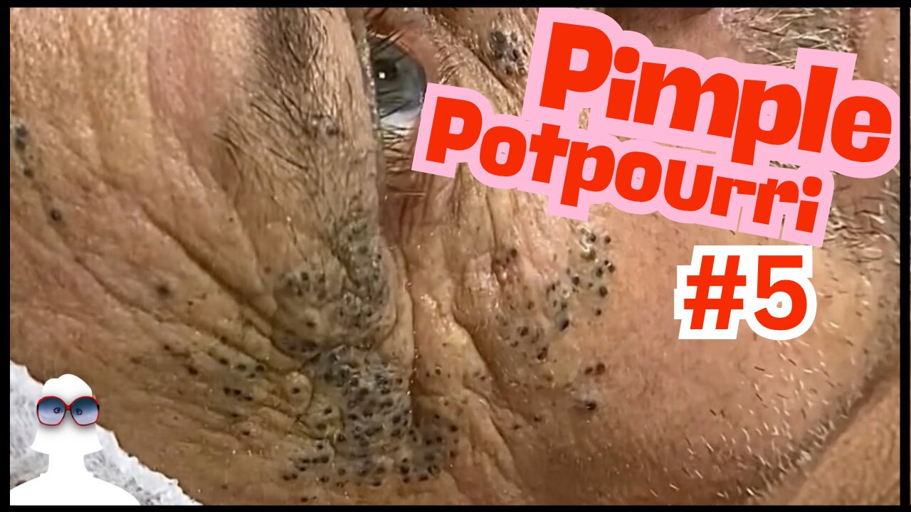 PIMPLE Potpourri #5