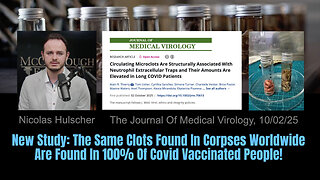 New Study: The Same Clots Found In Corpses Worldwide Are Found In 100% Of Covid Vaccinated People!