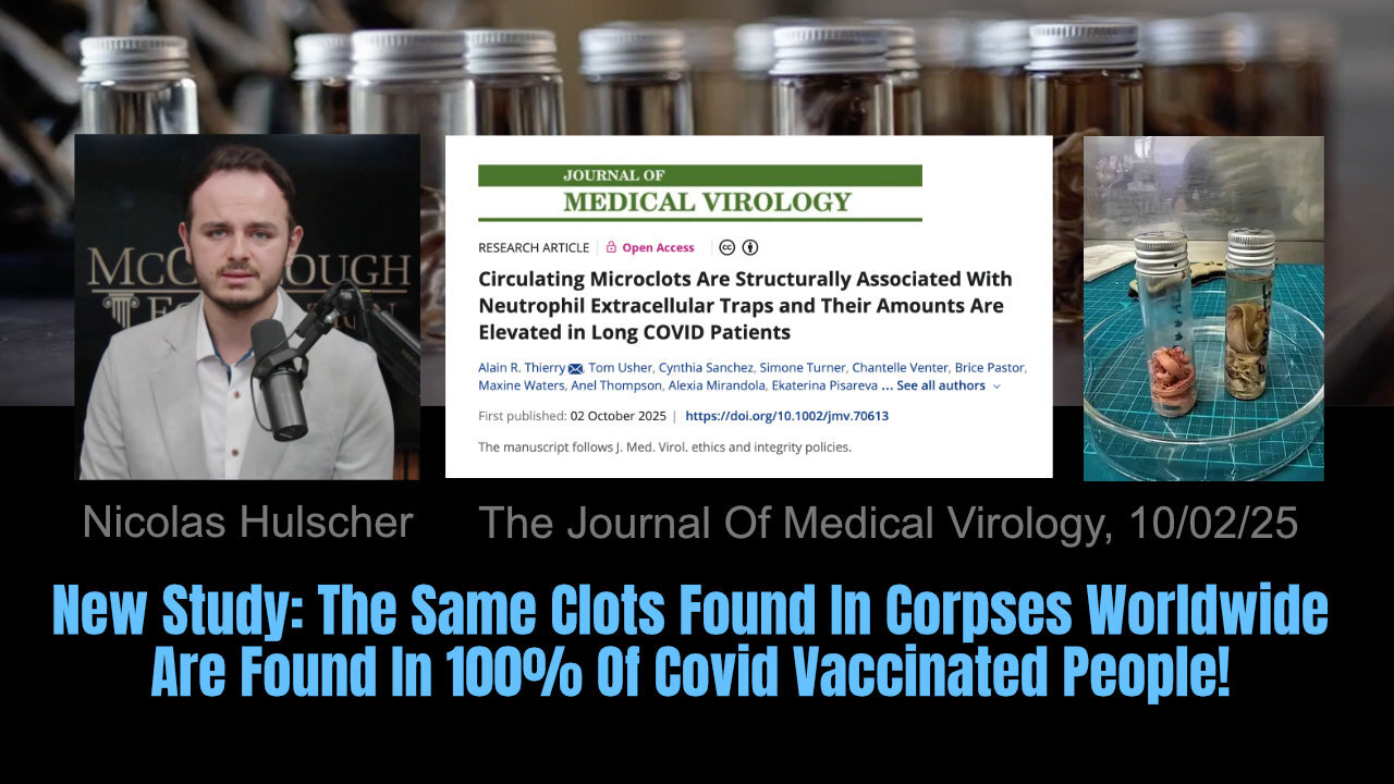New Study: The Same Clots Found In Corpses Worldwide Are Found In 100% Of Covid Vaccinated People!