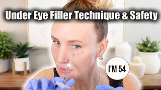 Under Eye Filler Orbital Bone Technique & Safety