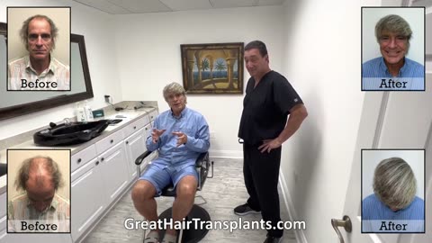 Mark’s MaxHarvest™ Plus Hair Transplant by Dr. Brett Brett Bolton