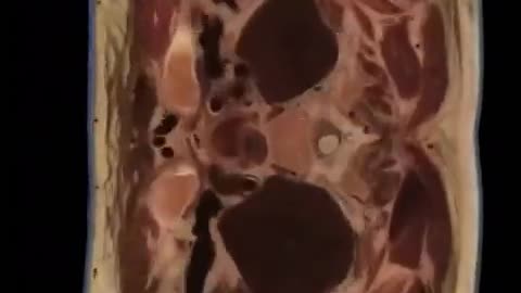 😮✨ Explore Cross Sections of the Female Human Body! | FeedMyCuriosity
