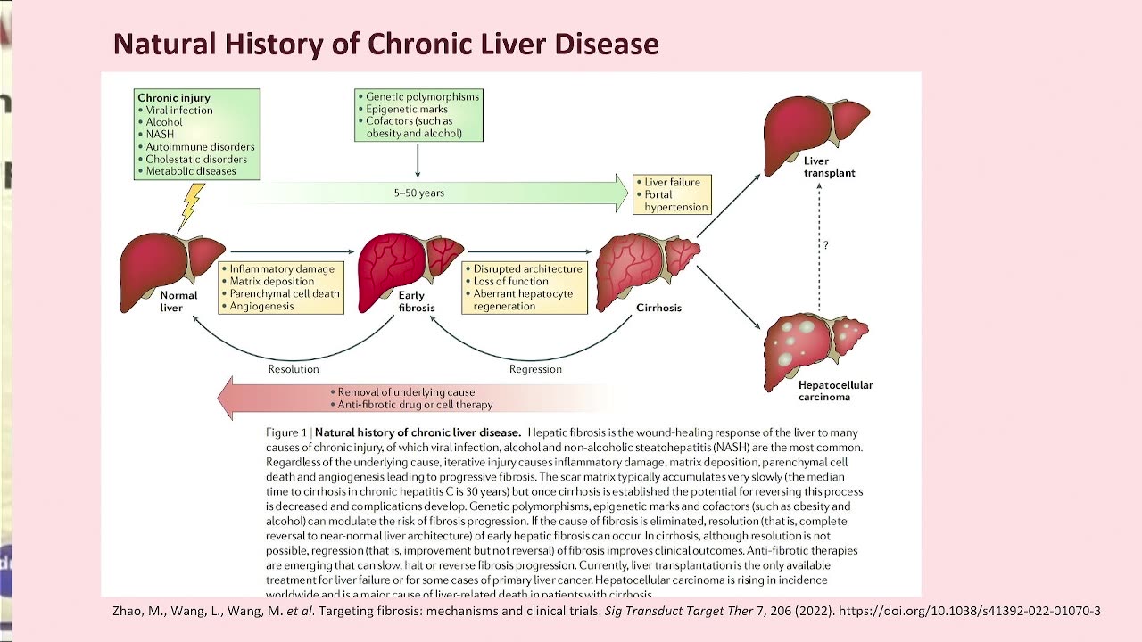presentation on liver disease