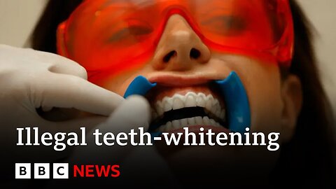 Illegal teeth-whitening industry exposed by BBC | BBC News