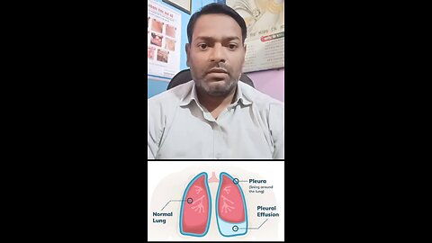 फेफड़ों में पानी भरने के लक्षण ।