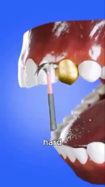 Gwahahahahahahahahaha