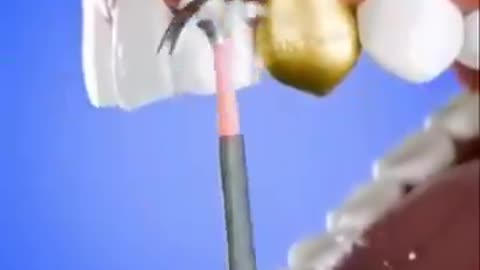 Gwahahahahahahahahaha