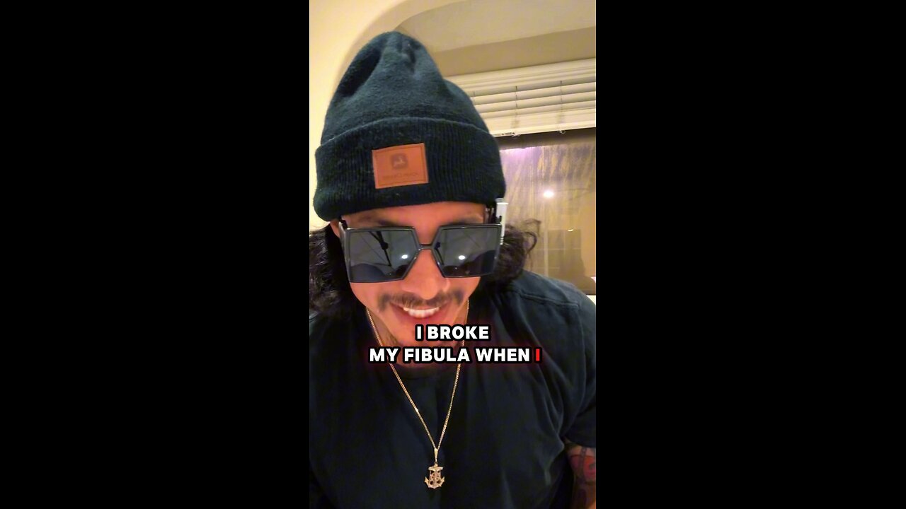 I Broke My Fibula