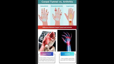 Carpal Tunnel & Arthritis: A Revolutionary Holistic Guide for Pain-Free Living