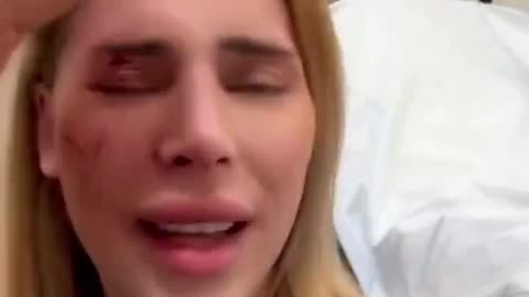 transgender pro-Palestinian Calysta Goblet has been beaten up by a group of young North African