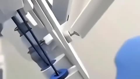 Why Do Doctors Remove the Prostate Here’s How This Life-Saving Surgery Works!