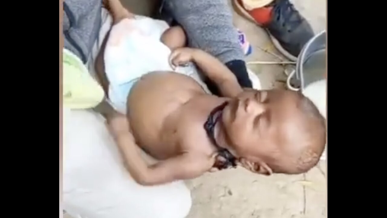 Uttar Pradesh: Twins died following multiple vaccinations