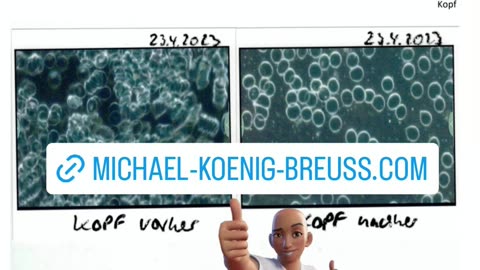 Dunkelfeld-Mikroskop-Bilder von SEELENSPRACHE - LICHTSPRACHE = COVID Ausleitung!