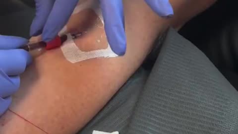 "You said you had the Pfizer vaccine right? Yes I did" Blood Clots