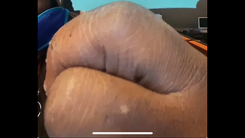 KEVIN JONES GETS CLIPPED SHOWING TAMMY PEAY OLD ASHY bloody knuckles