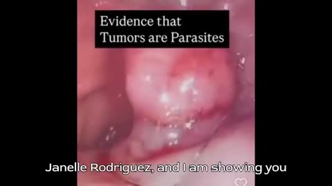 WHAT YOU'RE ABOUT TO SEE HAS BEEN IGNORED AND COVERED UP ALL OVER THE WORLD!