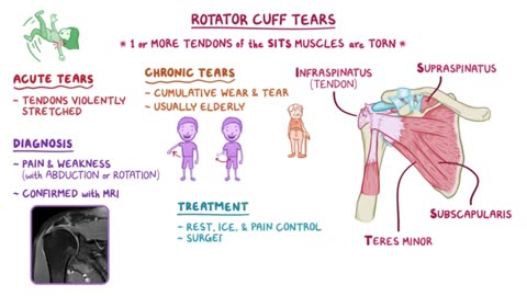 Rotary cuff tear