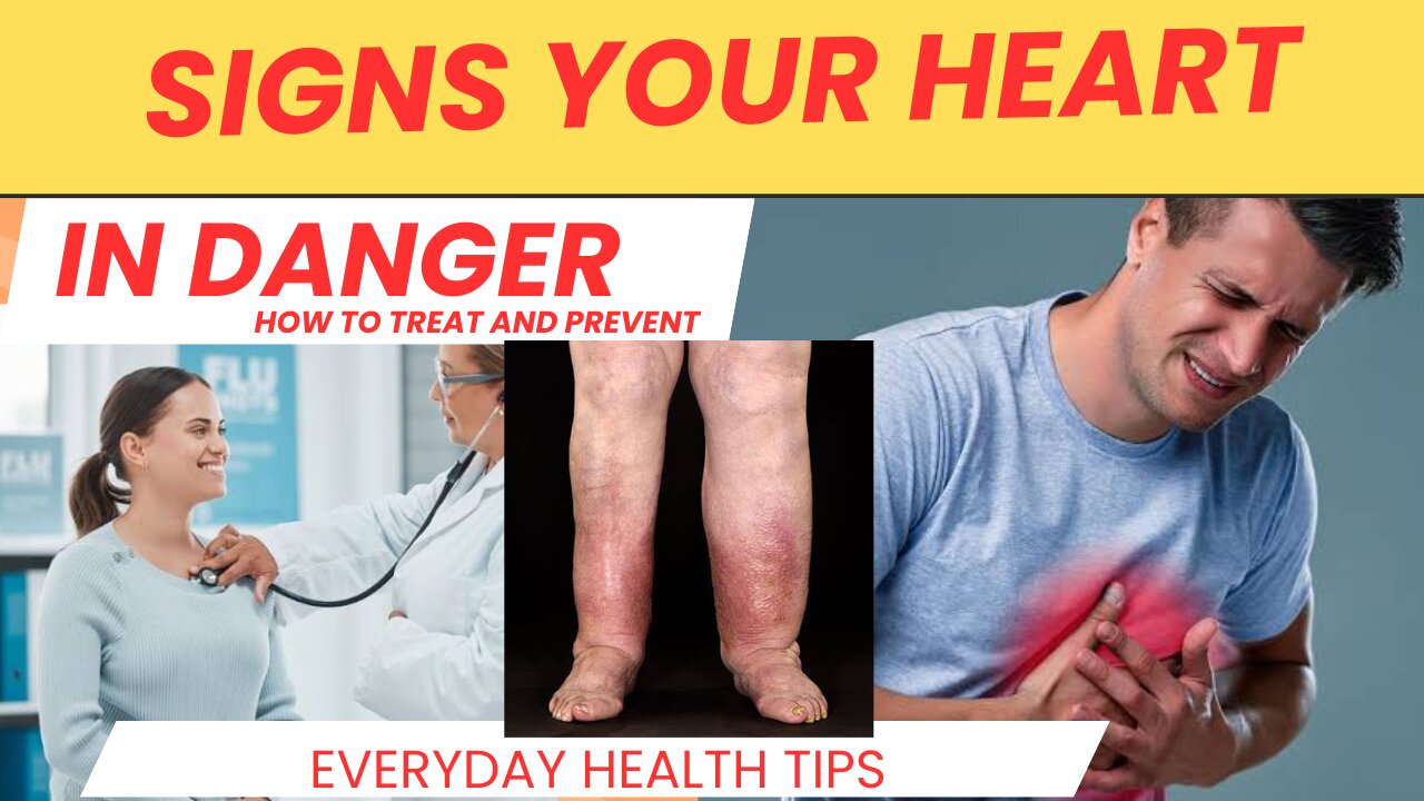 🚨 HEART ATTACK WARNING SIGNS!! (You NEED to Know These!) 🚨