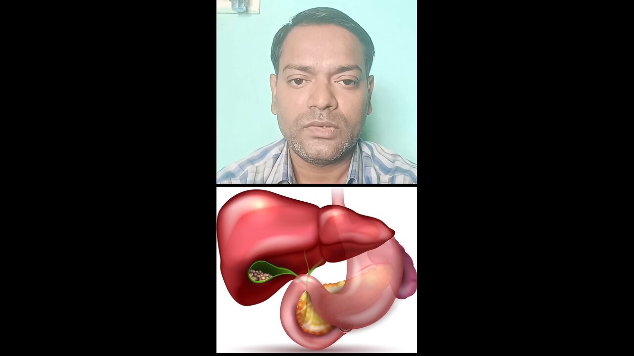 पित्ताशय की पथरी ।