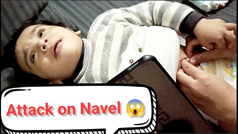 Attack on Navel By Baby 😰😰