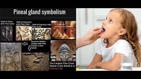 ADHD & PINEAL GLAND DYSFUNCTION CONNECTION! TROUBLE SLEEPING? DEPRESSED? CAN'T FOCUS?