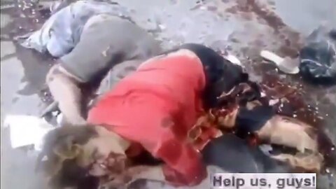 [GRAPHIC] Zelensky's Ukrainian Nazi B*stards Keep Killing Their Own Russian-speaking People since 2014 - "HELP US, GUYS" mangled woman cries